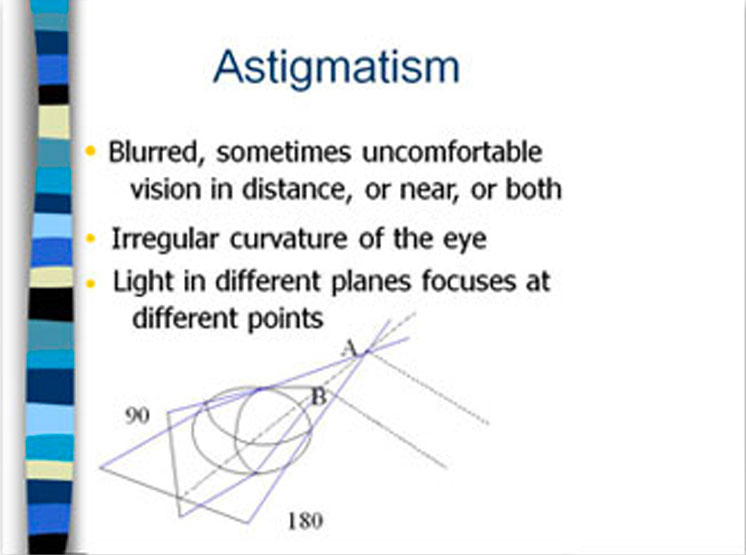 astigmatism2